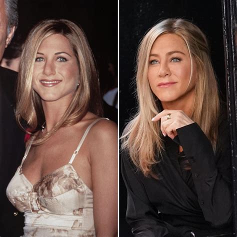Jennifer Aniston Has Been Open About Her Plastic Surgery — Learn What ... 