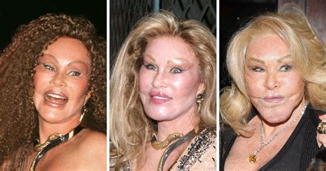 Jocelyn Wildenstein Before And After Plastic Surgery
