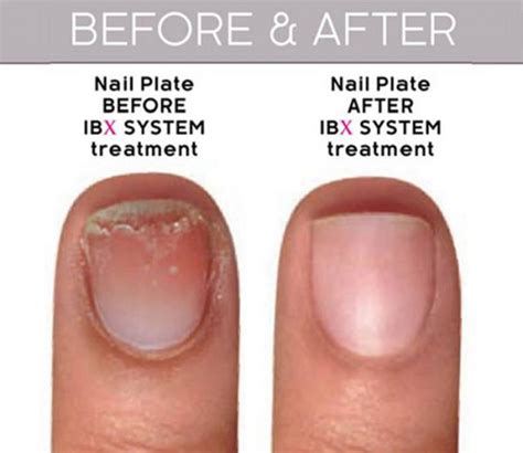 Fact-check: How does IBX Nail Strengthening Treatment Work? | Lab ...