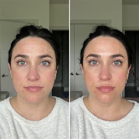 ziip device results  review ivy boyd makeup