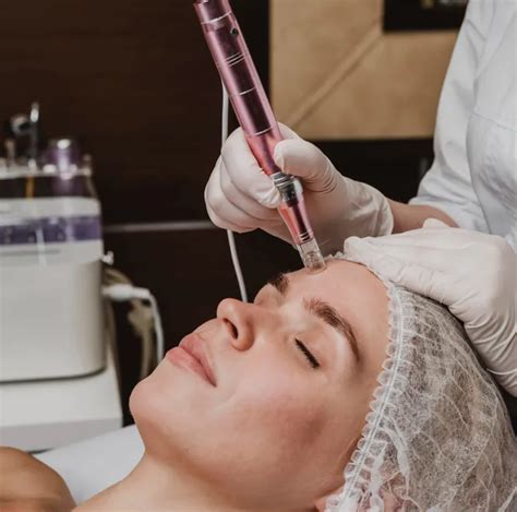 Micro-needling Rejuvenation - Spazen.net