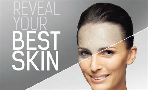 Nimue Skin Technology UK