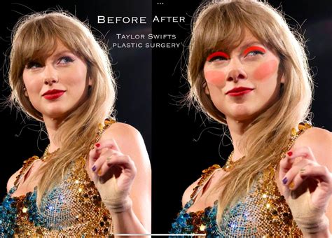 Taylor Swift Implantsforum Implants Fessiers