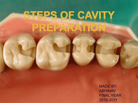 Steps Of Cavity Preparation