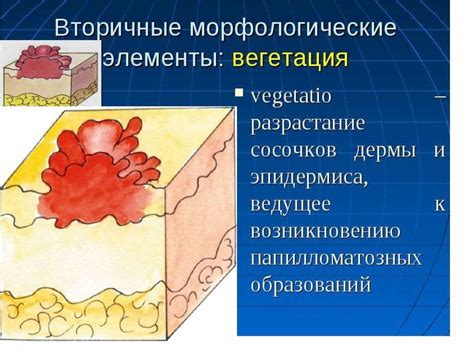 Морфологические элементы кожи - презентация онлайн