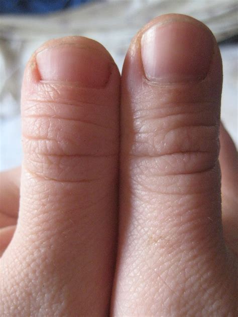 Small Thumb Nail at Nathan Lozano blog