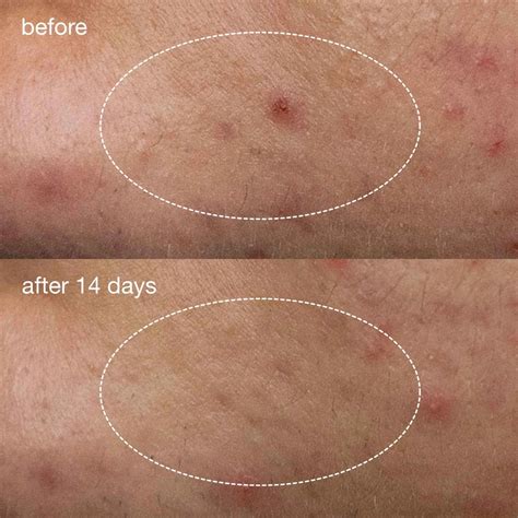 The Murrieta Patch Phenomenon: A Deep Dive. Image 17