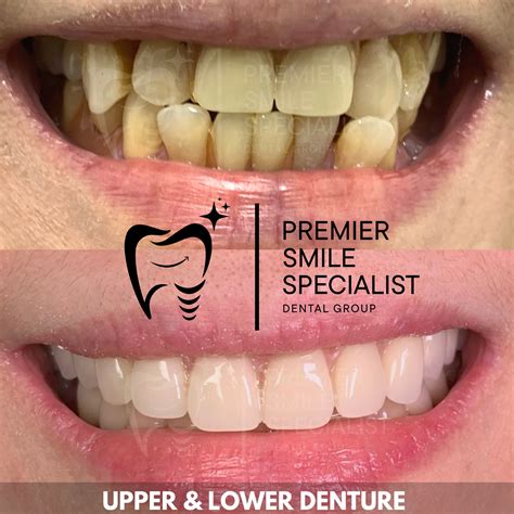 Premier Smile Specialist Dental Clinic | Parañaque
