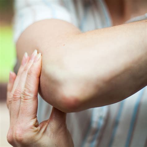 signs  elbow dislocation dines orthopedics