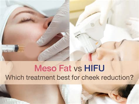 Meso Fat vs HIFU : Which Treatment Works Best for cheek | La Grace Clinic