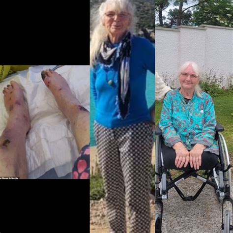 GRANDMA’S LEGS AMPUTATED AFTER ‘MOSQUITO’ BITE, SEE PHOTOS 🎯 The Scoper
