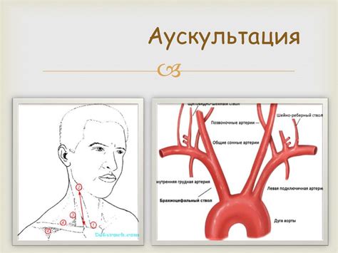 Артериит Такаясу (неспецифический аортоартериит, «болезнь отсутсвия ...