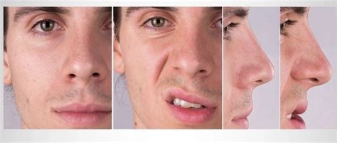 levator labii superioris muscle origin insertion function