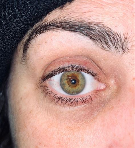 Central heterochromia-green or brown or hazel?