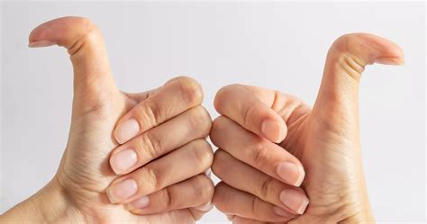 What does it mean to be double-jointed and is it harmful?