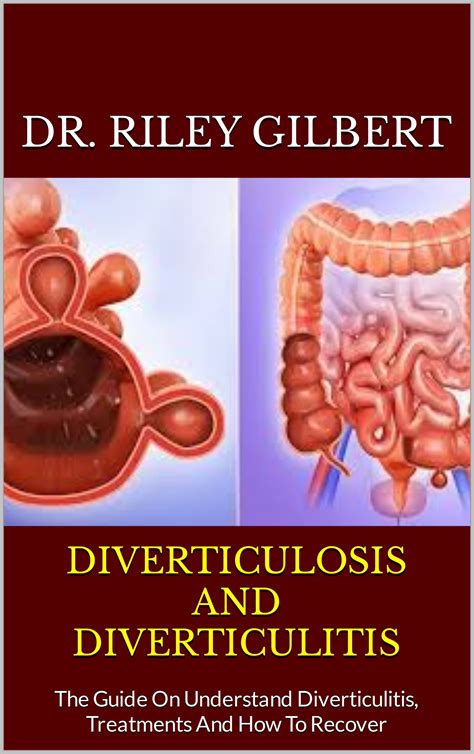 Diverticulosis And Diverticulitis The Guide On Understand