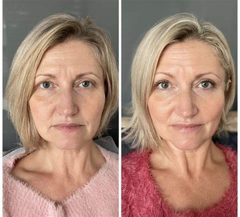 Dee Why Skin Cancer And Cosmetic Clinic | Dee Why NSW