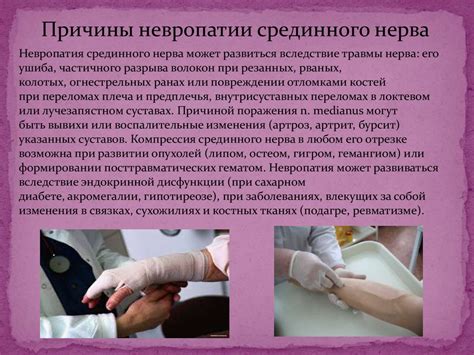 Нейропатия срединного нерва - презентация онлайн