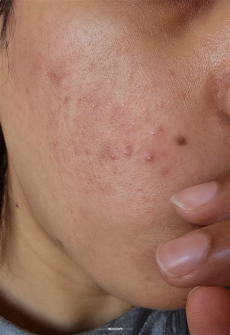 Ask a Dermatologist Online for Skin Irritation And Itching