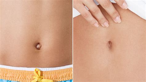 How To Make Your Belly Button Go In Without Surgery