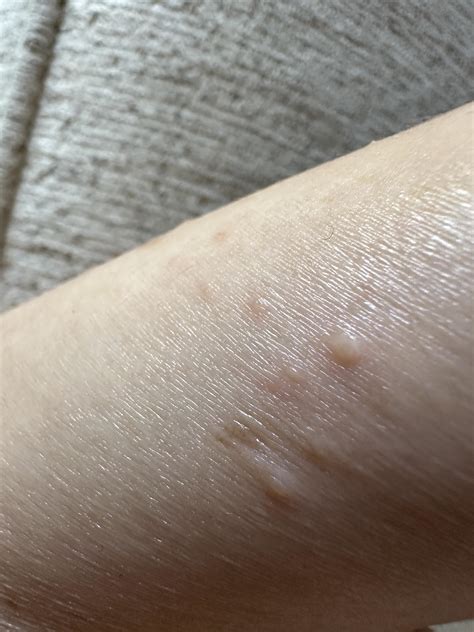 Skin very itchy all of a sudden help what to do? : r/medical_advice