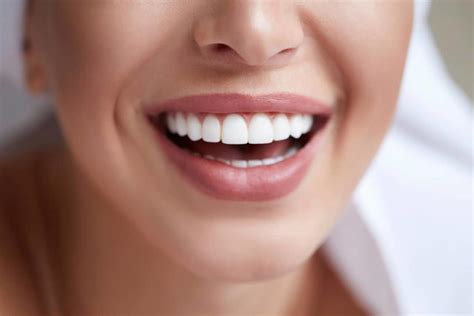 4 Veneer Preparation Methods for Satisfied Patients - STOMADENT