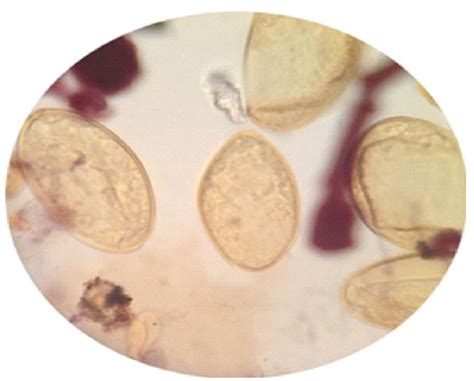 Fasciola hepatica eggs magnification 10x. | Download Scientific Diagram