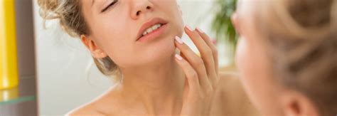Soothing Relief for Pustular Psoriasis on the Face