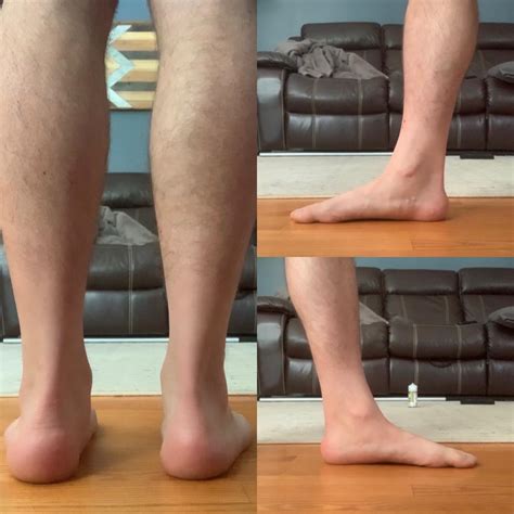 Do I have flat feet and does my right foot look over pronated? : r