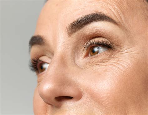 types    skin ageing