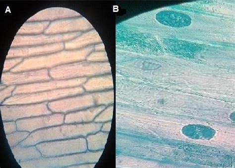 Celula Da Cebola - Epiderme de cebola: observação microscópica, organização ...