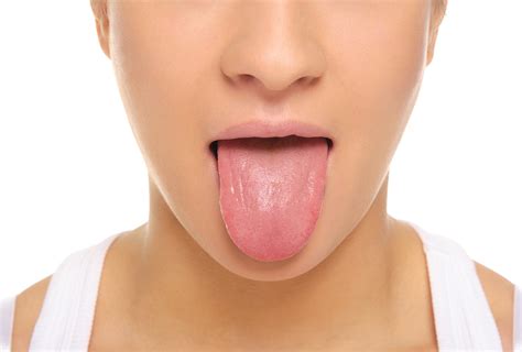 How to Manage Geographic Tongue at Home - eMediHealth