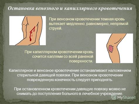 Презентация на тему: "Раны и первая медицинская помощь при ранениях ...