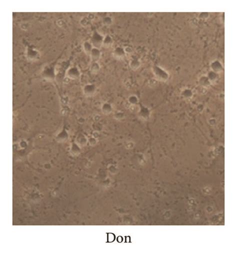 The cell growth status and fluorescence of Aβ1–42-induced hippocampal ...