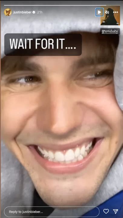 Justin Bieber се усмихва отново след частична парализа на лицето