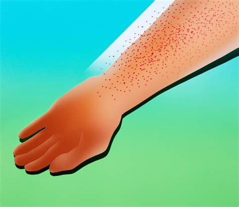Weird Skin Rashes