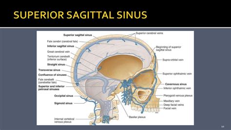 Parasagittal Meningioma