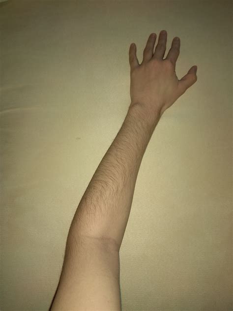 Upper Arm Hair Female at Queen Hanna blog