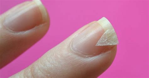 Как восстановить ногти? Советы на все случаи! - Modnail.ru - Красивый ...