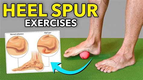 exercises  plantar fasciitis  heel spur  clyde miller blog