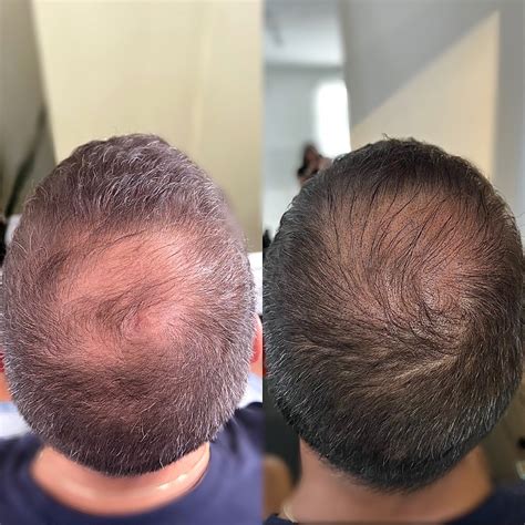 hair tattoo near me