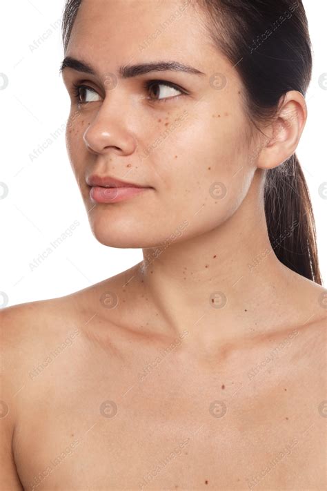 Beautiful woman with birthmarks on white background: Stock Photo