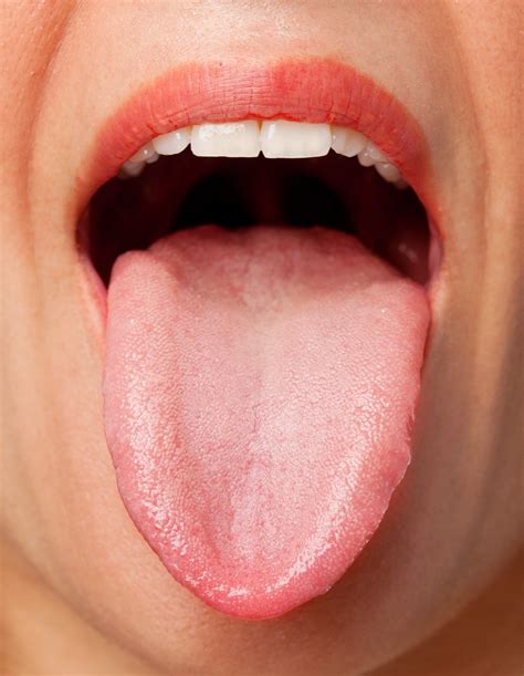 The Tongue: A Window to Your Health - What Your Tongue Reveals About