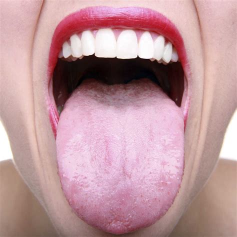 Where You Live May Determine What Lives Inside Your Mouth : Shots ...
