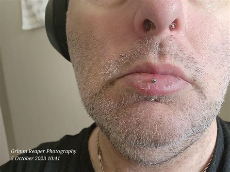 Lip peeling after piercing. : r/piercing