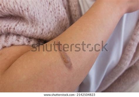 26,713 Burnt Cooking Images, Stock Photos & Vectors | Shutterstock