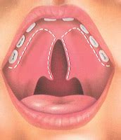 Treatment | Cleft Lip and Palate