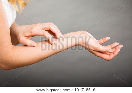 Dermatology Allergy Image & Photo (Free Trial) | Bigstock