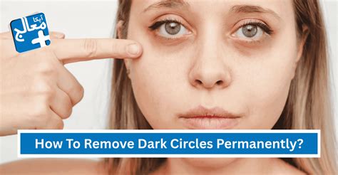 remove dark circles permanently  home remedies