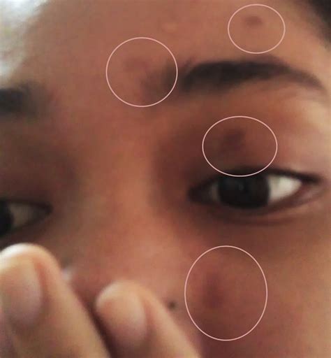 cara menghilangkan minyak di muka 13